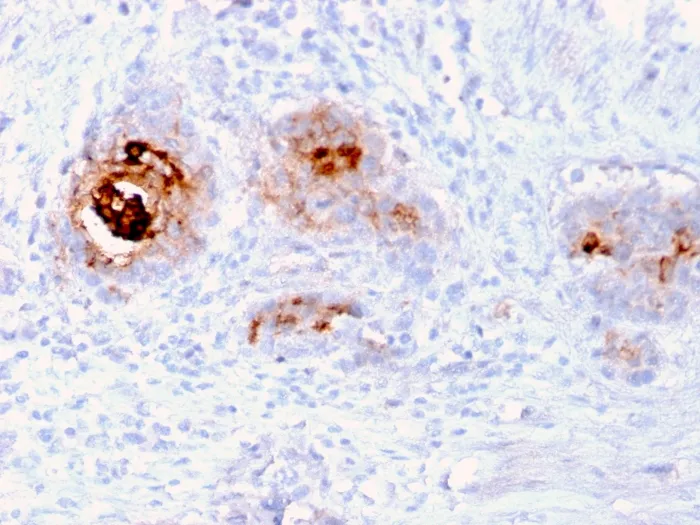 Anti-TAG-72 / CA72.4 (Tumor-Associated Glycoprotein)(rB72.3) - image 1