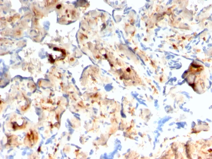 Anti-S100A4 / Metastasin / Calvasculin (Marker of Tumor Metastasis)(rS100A4/1481) - image 1