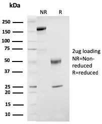 Anti-ER-beta-1 (Estrogen Receptor beta-1)(ESR2/3207) - image 1