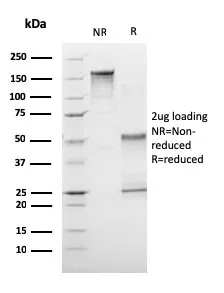 Anti-CD1a / HTA1 (Mature Langerhans Cells Marker)(C1A/3249), CF568 conjugate - image 1