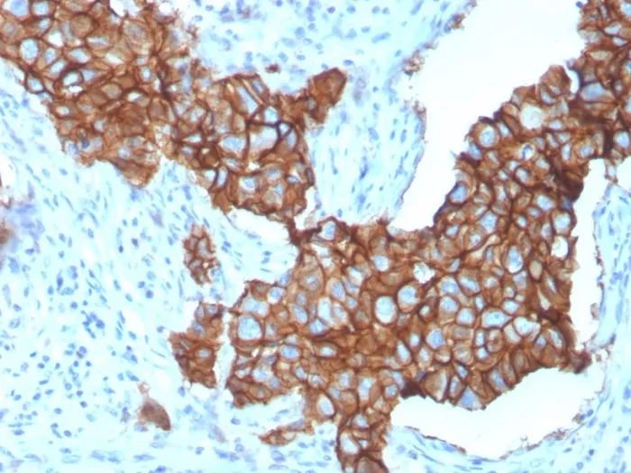 Anti-HER-2 / c-erbB-2 / neu / CD340(ERBB2/3257), Biotin conjugate - image 1