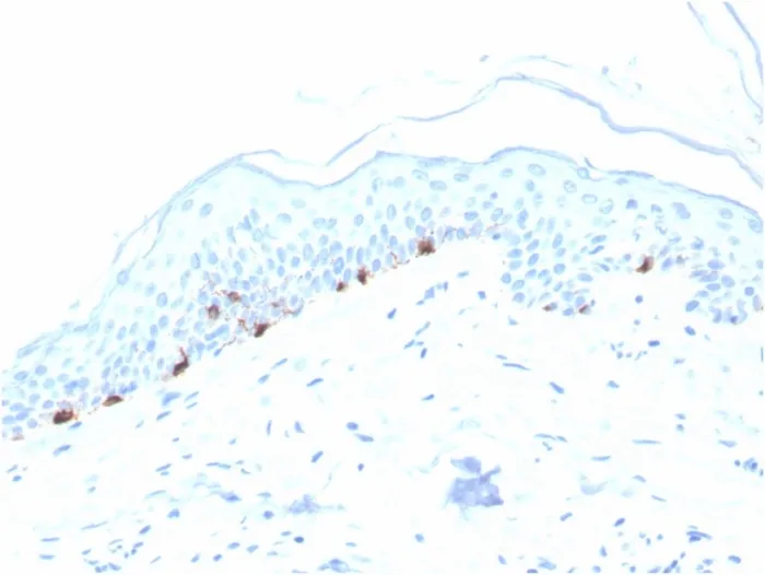 Anti-Tyrosinase-Related Protein-1 (TYRP-1) (Melanoma Marker)(TYRP1/3280), CF488A conjugate - image 1