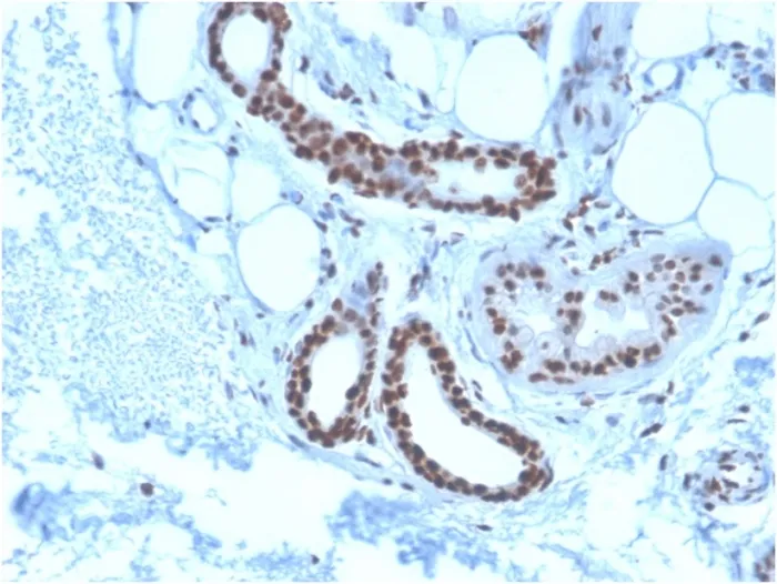 Anti-Nucleophosmin (Acute Myeloid Leukemia Marker)(NPM1/3285) - image 1