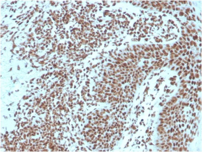 Anti-Nucleophosmin (Acute Myeloid Leukemia Marker)(NPM1/3287) - image 1