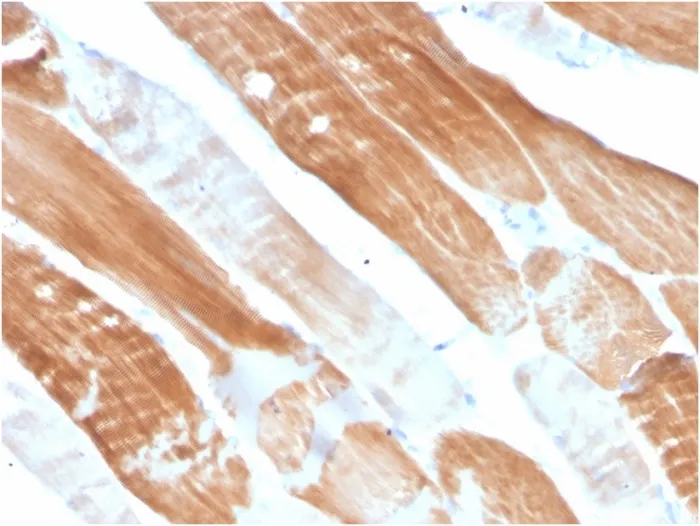 Anti-Sarcomeric Actinin Alpha 2 / ACTN2(ACTN2/3291) - image 1