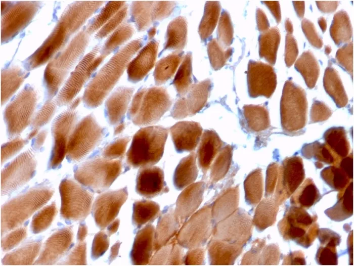 Anti-Sarcomeric Actinin Alpha 2 / ACTN2(ACTN2/3292) - image 1