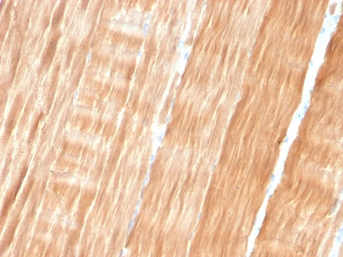 Anti-Sarcomeric Actinin Alpha 2 / ACTN2(ACTN2/3293) - image 1