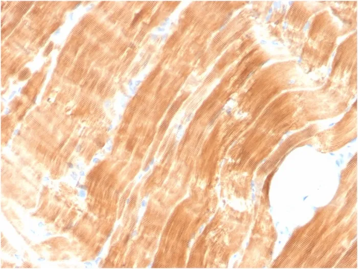 Anti-Sarcomeric Actinin Alpha 2 / ACTN2(ACTN2/3294) - image 1