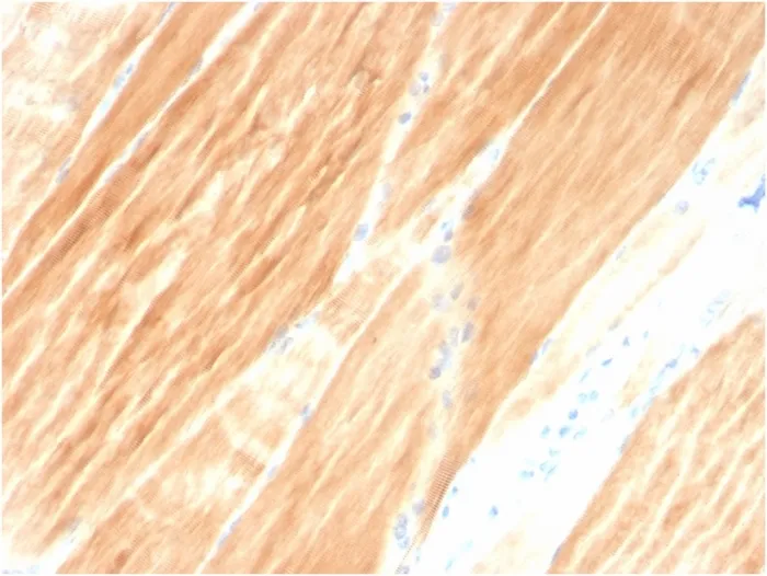 Anti-Sarcomeric Actinin Alpha 2 / ACTN2(ACTN2/3295) - image 1
