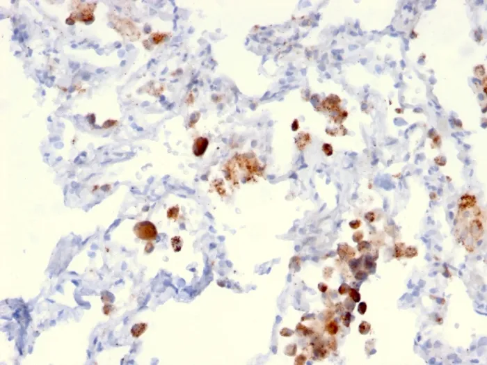 Anti-Napsin A (Lung Adenocarcinoma Marker)(NAPSA/3306), CF405S conjugate - image 1
