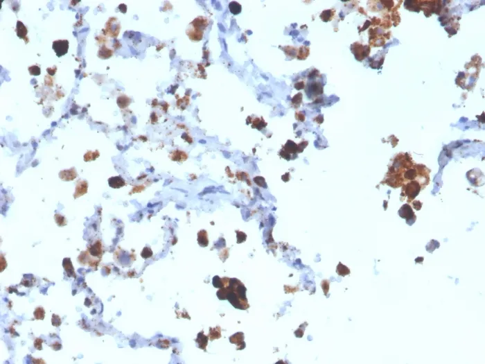 Anti-Napsin A (Lung Adenocarcinoma Marker)(NAPSA/3308), CF405S conjugate - image 1
