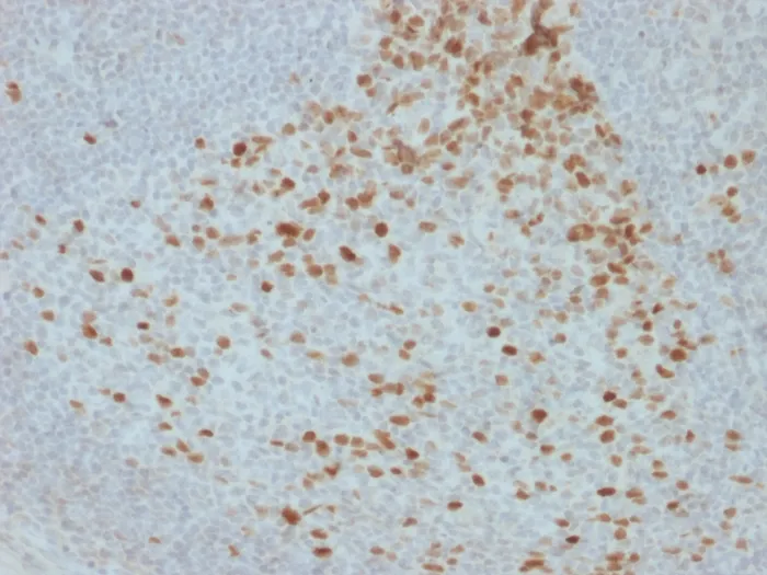 Anti-Proliferation Marker(JC1) - image 1