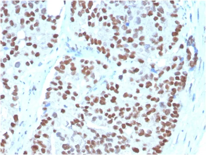 Anti-NKX3.1 (Metastatic Prostate Adenocarcinoma Marker)(NKX3.1/3348), CF488A conjugate - image 1