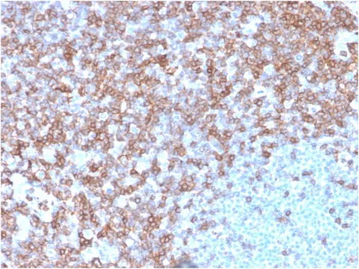 Anti-CD43 (T-Cell Marker)(SPN/3388) - image 1