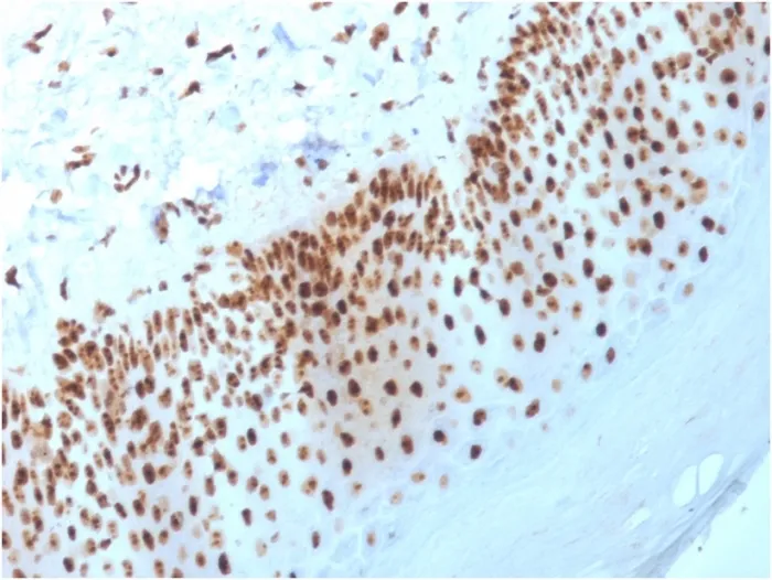 Anti-Nucleophosmin (Acute Myeloid Leukemia Marker)(NPM1/3398), CF594 conjugate - image 1