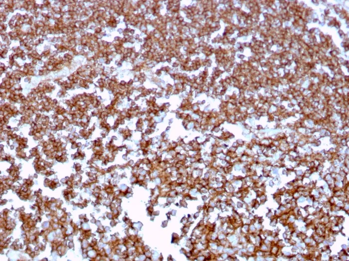 Anti-CD20 / MS4A1 (B-Cell Marker)(MS4A1/3409) - image 1