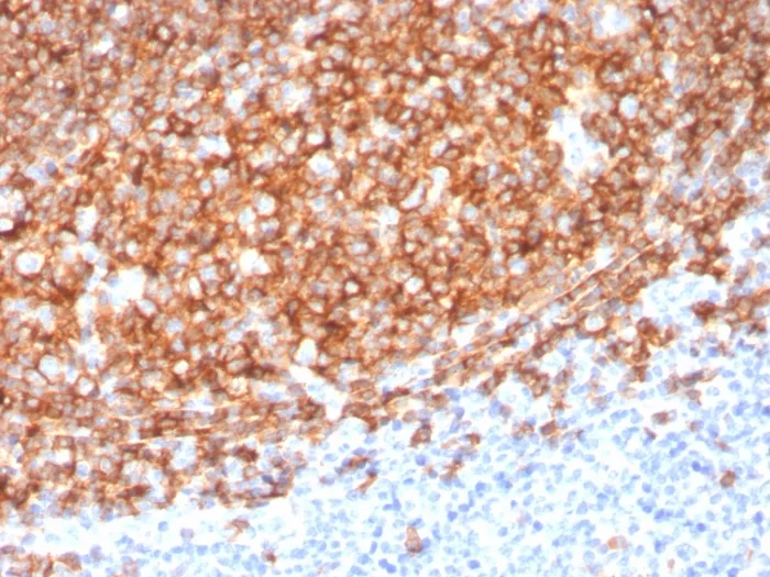 Anti-CD20 / MS4A1 (B-Cell Marker)(MS4A1/3410) - image 1