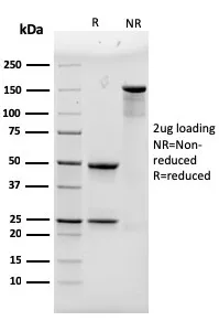 Anti-Alpha Actinin 4 / ACTN4(93) - image 1