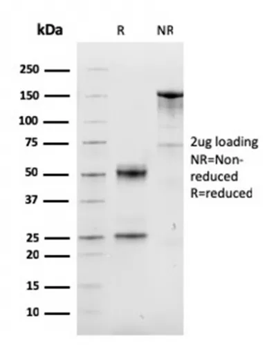 Anti-Cyclin D1 (G1-Cyclin & Mantle Cell Lymphoma Marker)(CCND1/3548), CF647 conjugate - image 1