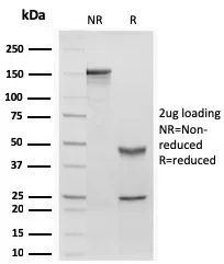 Anti-Retinol Binding Protein-1 (RBP1)(rRBP1/872), Biotin conjugate - image 1