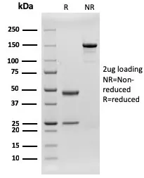 Anti-CD79b (B-Cell Marker)(rIGB/1842) - image 1
