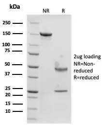 Anti-Langerin / CD207 (Marker of Langerhans Cells)(rLGRN/1821) - image 1
