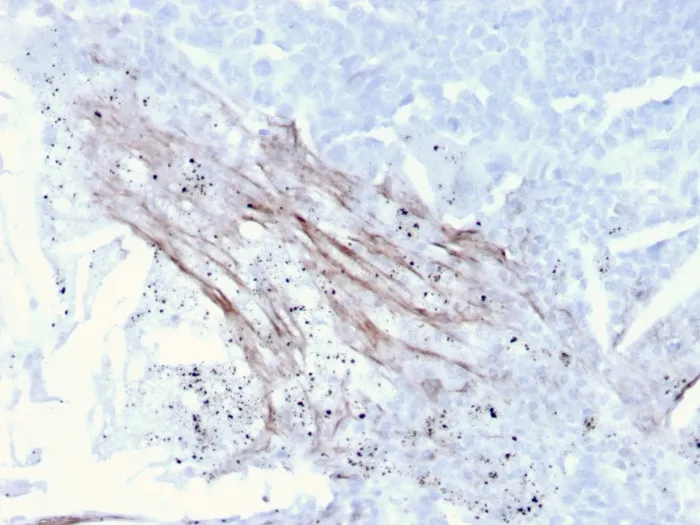 Anti-Tenascin C (Stromal Marker for Epithelial Malignancy)(TNC/3635) - image 1