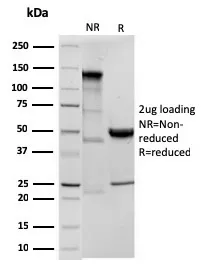 Anti-Ornithine Decarboxylase-1 (ODC-1)(ODC1/3636R), CF647 conjugate - image 1