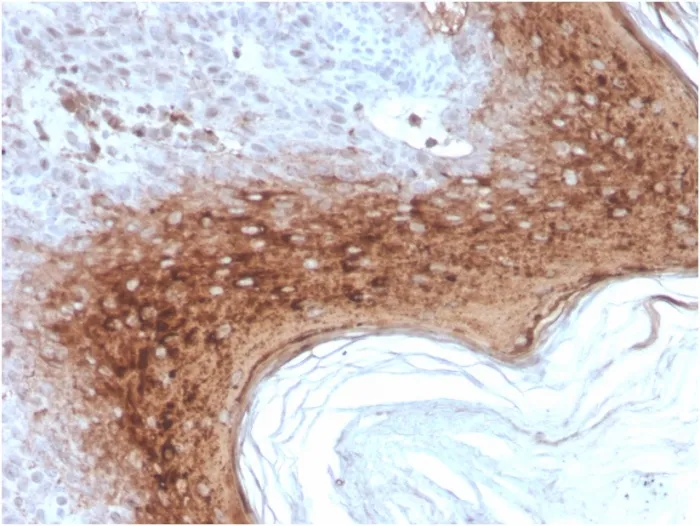 Anti-Involucrin (Squamous Cell Terminal Differentiation Marker)(rIVRN/827) - image 1