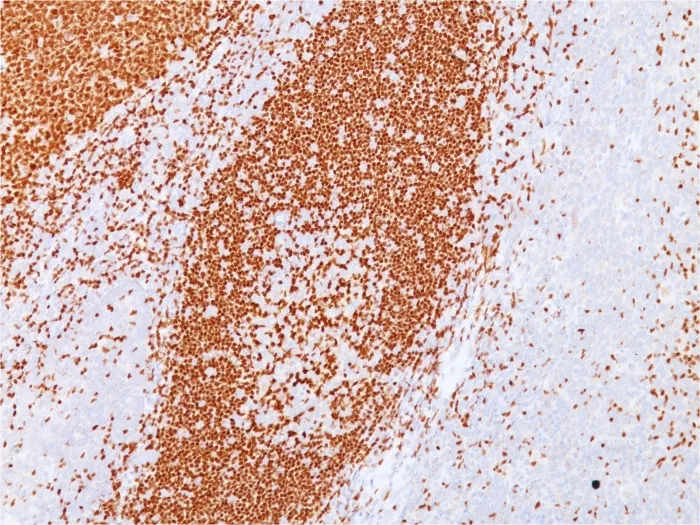 Anti-PAX5 / BSAP (Early B-Cell Marker)(PAX5/3735) - image 1
