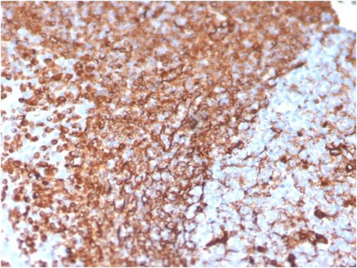 Anti-Vimentin (Mesenchymal Cell Marker)(VIM/3736) - image 1