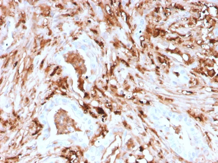 Anti-Ferritin, Light Chain (Node-Negative Breast Tumor Prognostic Marker)(rFTL/1388), CF568 conjugate - image 1