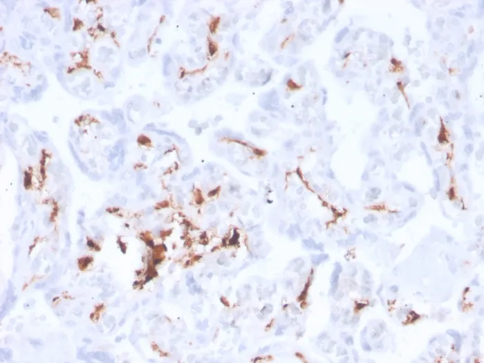Anti-Factor XIIIa (Coagulation Factor XIIIA Chain)(F13A1/3772R) - image 1