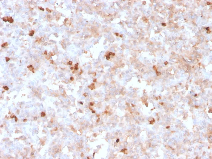 Anti-Lambda Light Chain (B-Cell Marker)(rLLC/1738) - image 1