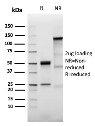 Anti-Prolactin Receptor (hPRL Receptor)(PRLR/3785R), CF640R conjugate - image 1