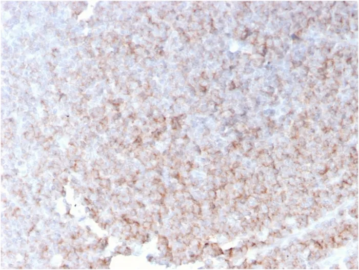 Anti-CD21 (Mature B-Cell & Follicular Dendritic Cell Marker)(rCR2/1952) - image 1