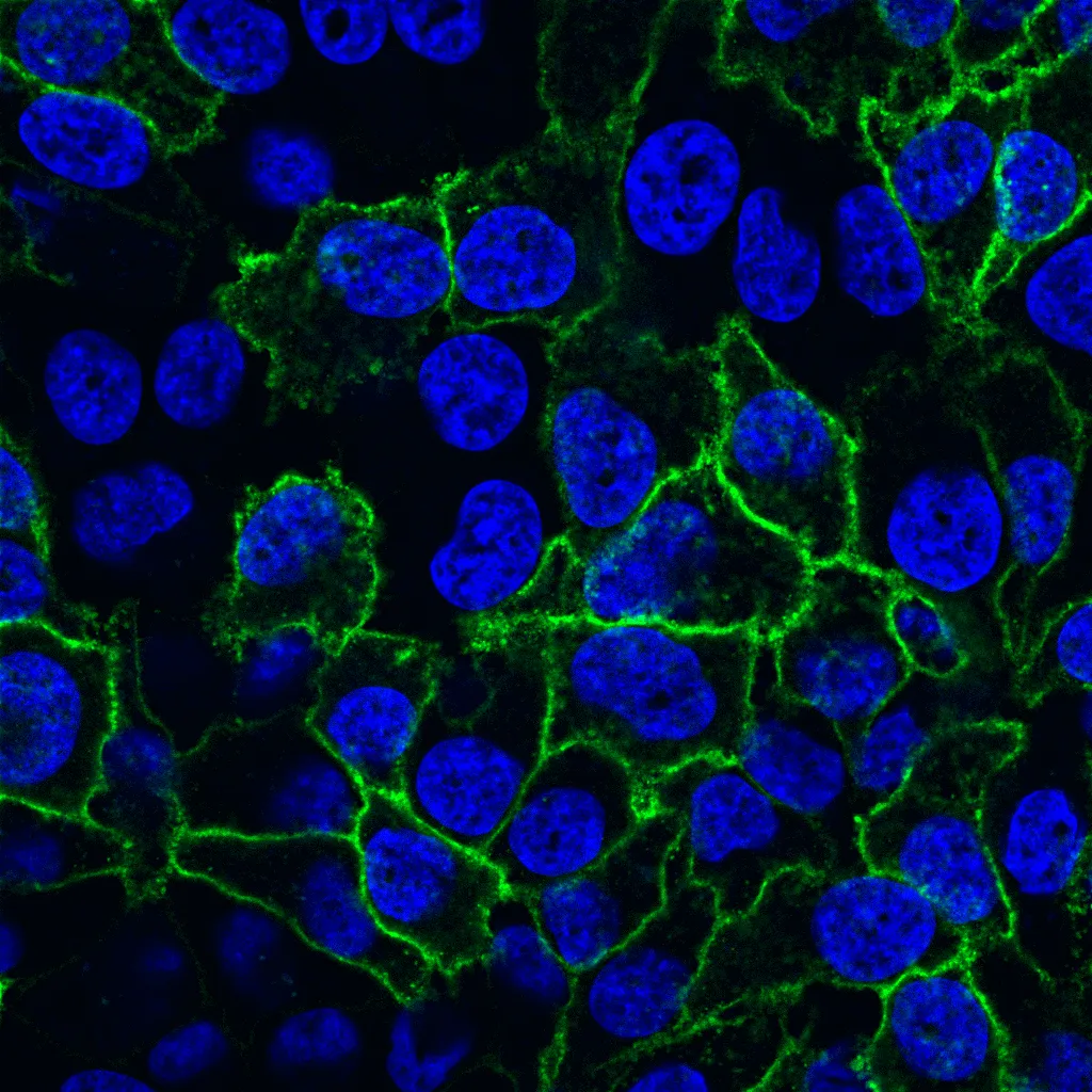 Cholera Toxin B, CF®488A Conjugate - image 2