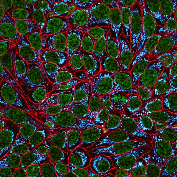 CellBrite™ Fix 555 Membrane Labeling Kit - image 2