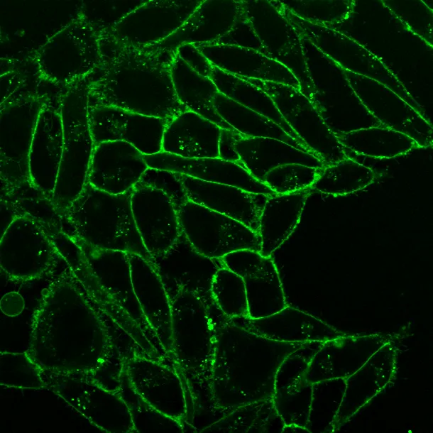 CellBrite™ Fix 555 Membrane Labeling Kit - image 6