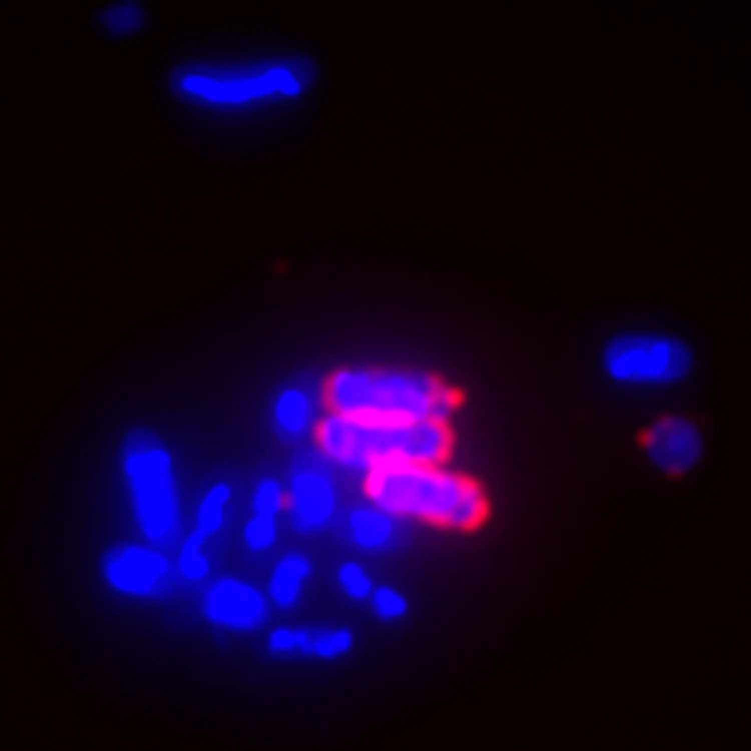 Live Bacterial Gram Stain Kit - 800 assays - image 2