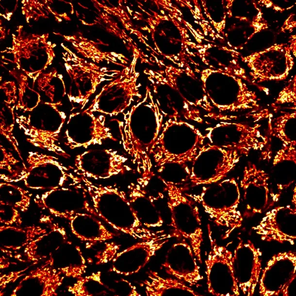 MitoView™ 405 - image 6