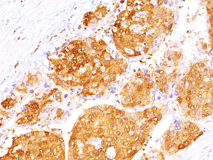 Anti-Arginase 1 (Hepatocellular Carcinoma Marker)(ARG1/1125+ ARG1/1126) - image 1