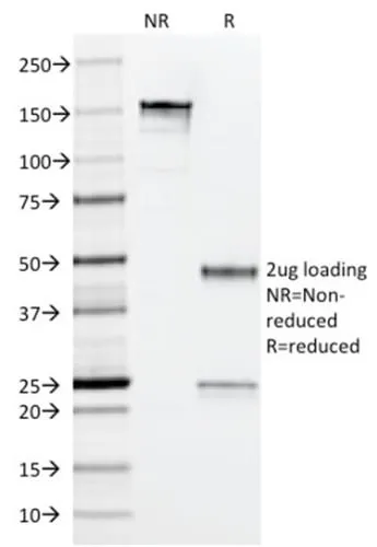 Anti-Arginase 1 (Hepatocellular Carcinoma Marker) (ARG1/1126) - image 2
