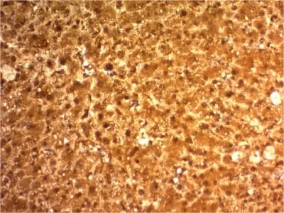 Anti-Arginase 1 (Hepatocellular Carcinoma Marker) (ARG1/1126) - image 1