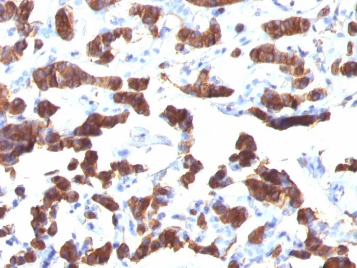 Anti-Thyroglobulin (Thyroidal Cell Marker)(TGB24) - image 1