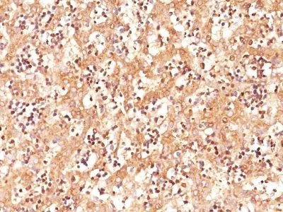 Anti-AFP (Alpha Fetoprotein)(C3), CF640R conjugate - image 1