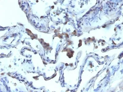 Anti-AMACR / p504S(Rabbit PAb), CF640R conjugate - image 2
