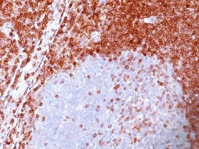 Anti-bcl-2(100/D5), CF640R conjugate - image 1