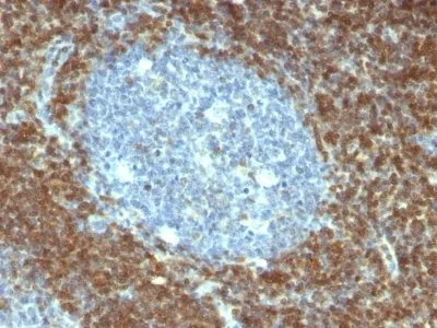 Anti-bcl-2(BCL2/796), CF647 conjugate - image 1