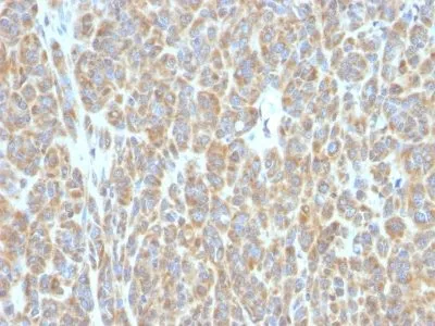 Anti-bcl-6(BCL6/850) - image 2
